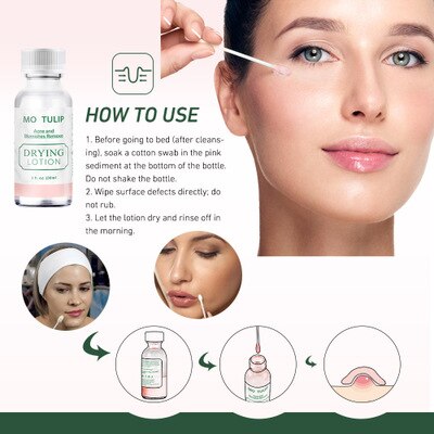 30ml effective Acne Treatment Mario Badescu Drying Lotion Anti Acne Serum Pimple Blemish Removal